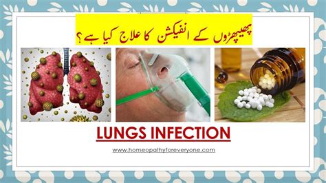 Homeopathy Medicines for Lungs 78 results Filter by Sort by Inula Homeopathy Dilution 6C, 30C, 200C, 1M, 10M From 2. . Homeopathy for fluid in lungs
